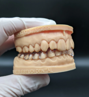 Prótesis dental en laboratorio.